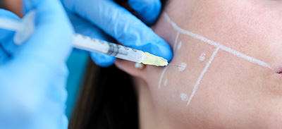 a woman receiving an anti-bruxism treatment with injections into her cheeks